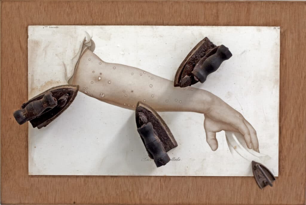 Daniel Spoerri, Journal médical Psoriasis guttata, 1990 © VG Bild-Kunst, Bonn, 2025. Courtesy Galerie LEVY